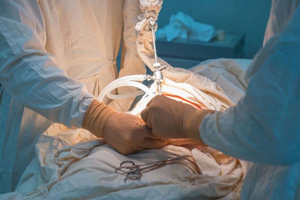 Eileiterschwangerschaft OP - laparoskopischer Eingriff